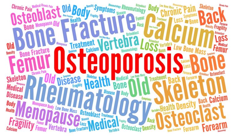 Colorful word cloud about bone health and osteoporosis, highlighting terms like Osteoporosis, Fracture, Calcium, Bone, Osteoclast, Osteoblast.